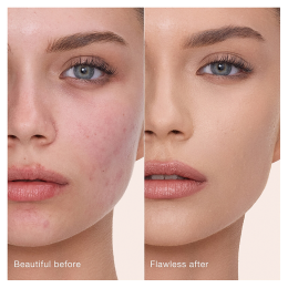 Консилер Charlotte Tilbury Airbrush Flawless Blur Concealer - №5 Medium